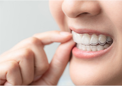 睡眠時のマウスピース装着