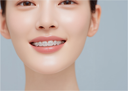 機能的矯正治療（GEAW法）