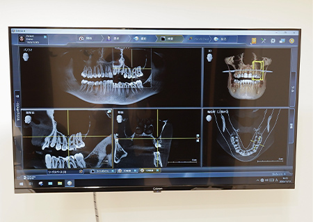 Axeos（アクセオス）