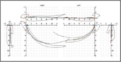 CADIAX（キャディアックス）