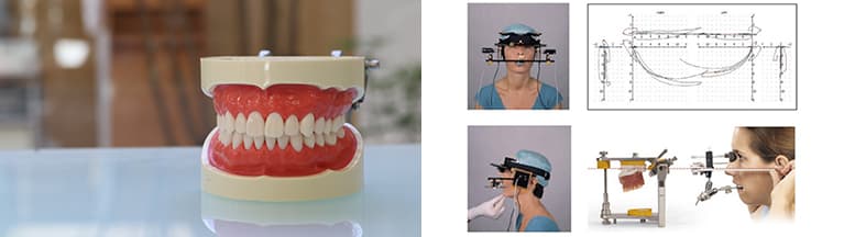 スムーズな歯の上下接触
