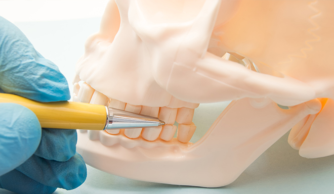 顎関節症・咬み合わせ治療