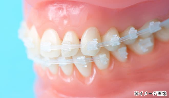 小臼歯を抜かない矯正歯科