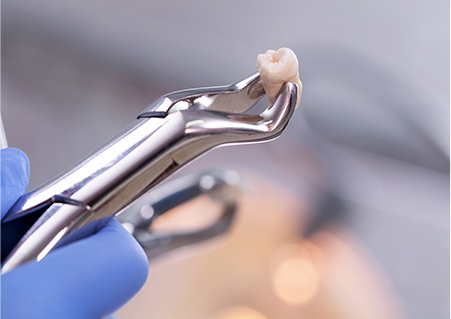 咬み合わせの乱れを予防