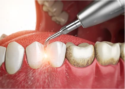 一般的な「守りの予防」