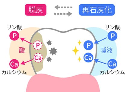 脱灰と再石灰化