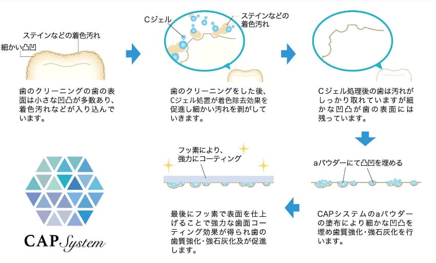 CAPシステムの作用の仕組み