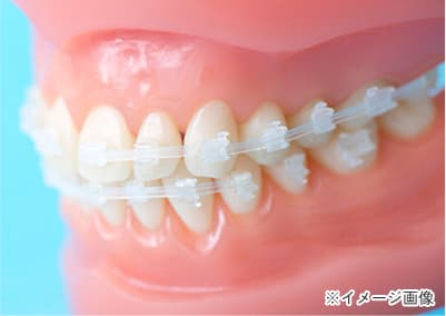 機能的矯正治療（GEAW法）