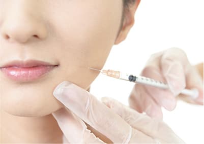 ボトックス治療