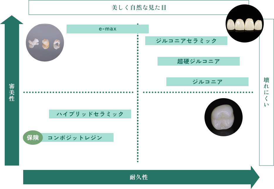 セラミック素材の種類と特長