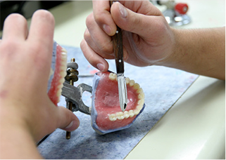 咬み合わせを考慮した精密な入れ歯作製