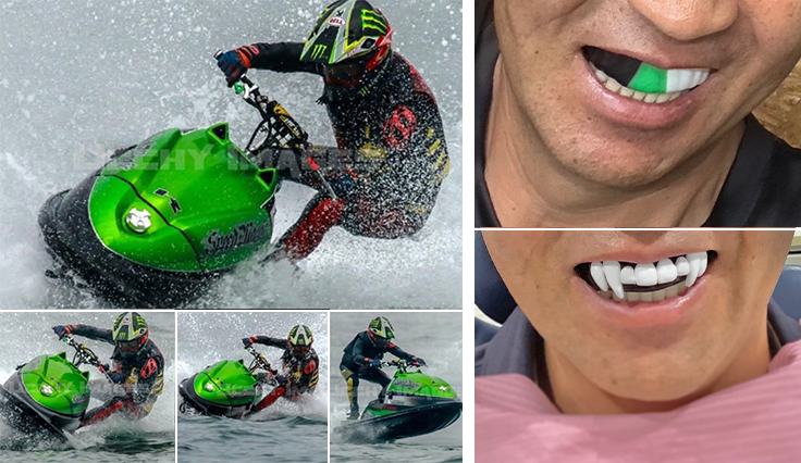 プロライダー 橋本祐一選手