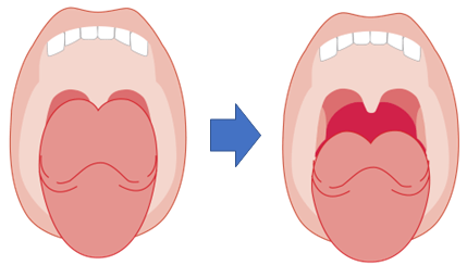 ナイトレーズの特徴
