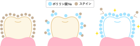 ポリリン酸ホワイトニングのしくみ